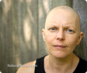 Болна-от-рак-жена-химиотерапия