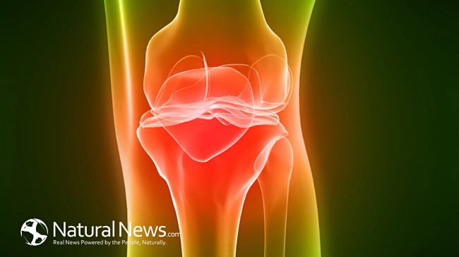 коляно артрит болка стави възпаление