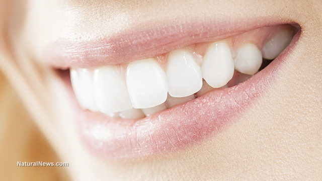 Жена-усмивка-бели-зъби