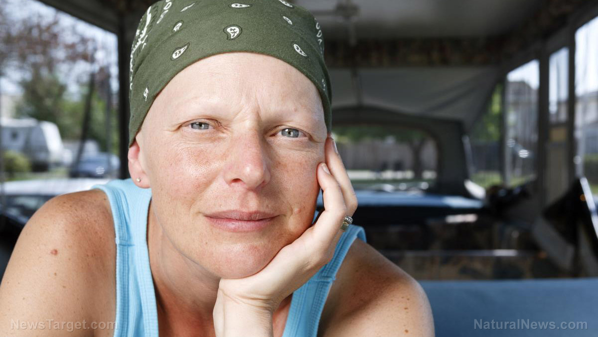 жена-химиотерапия-опадала-коса-рак